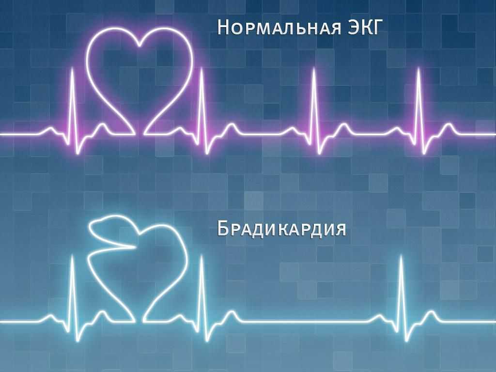 6 причин повышения артериального давления - врач-кардиолог батаев павел иванович